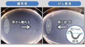 イメージ：【柔道整復師科＆鍼灸師科】線虫によるがん検査