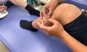 イメージ:【柔道整復師科・鍼灸師科】初めて自分の足に鍼を打ちました!